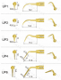 Spitze für Parodontalchirurgie UP1, 2, 3, 4, 5, 6, 7 serie für woodpecker/mectron ultrasurgery,CE/FDA