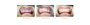 (Angebote!)Woodpecker Dental Scaler und Air Polisher AP-B,Elegantes Grau, schnelleres und bequemeres Scaling.CE/FDA