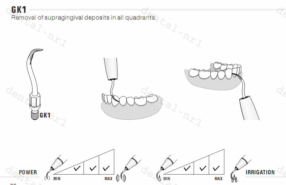 5stk Spitze Tipp GK1/ GK2/ GK3/ GK4/ GK5/ GK6/ GK7, KAVO* air scaler,Soniflex* 2003 kompatibel,CE/FDA