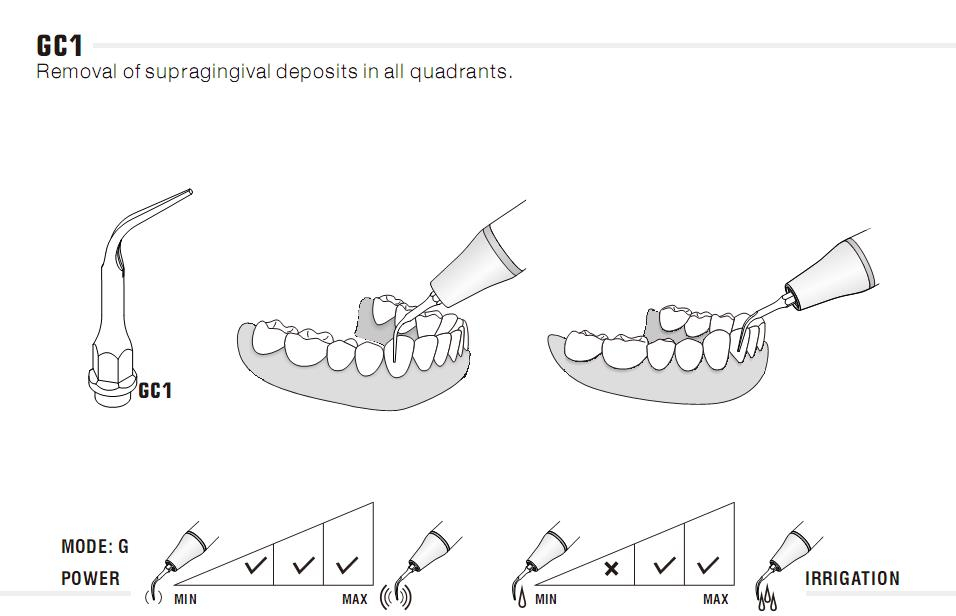5stk woodpecker Scaler Spitze Tipp GC1/ GC2/ PC1,*KaVo Sonasoft* kompatible ,CE/FDA