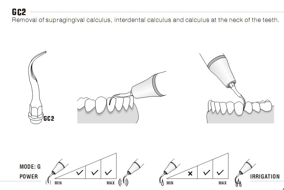 5stk woodpecker Scaler Spitze Tipp GC1/ GC2/ PC1,*KaVo Sonasoft* kompatible ,CE/FDA