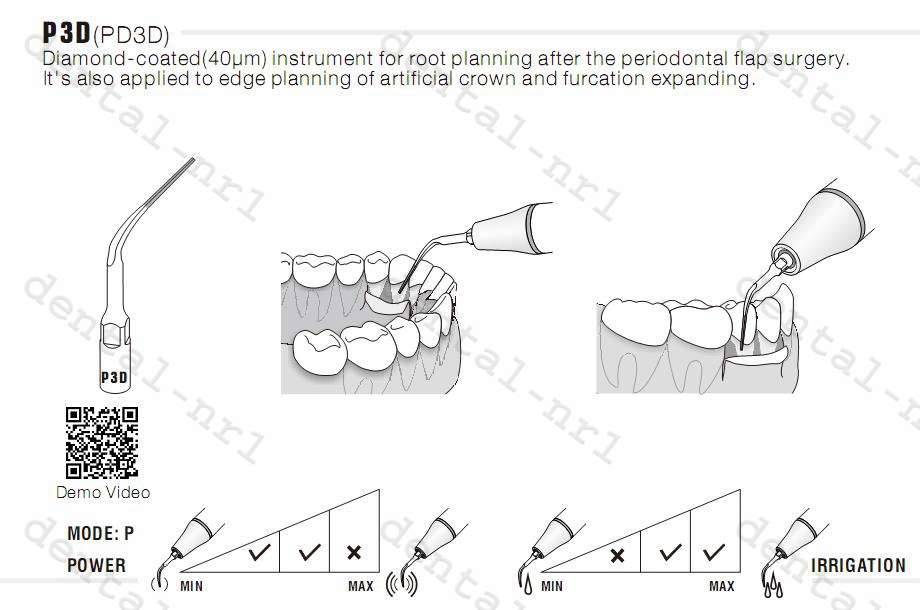 5stk/WOODPECKER ZEG Spitze PD3D,DTE Serie,Periodontics Tip,CE/FDA