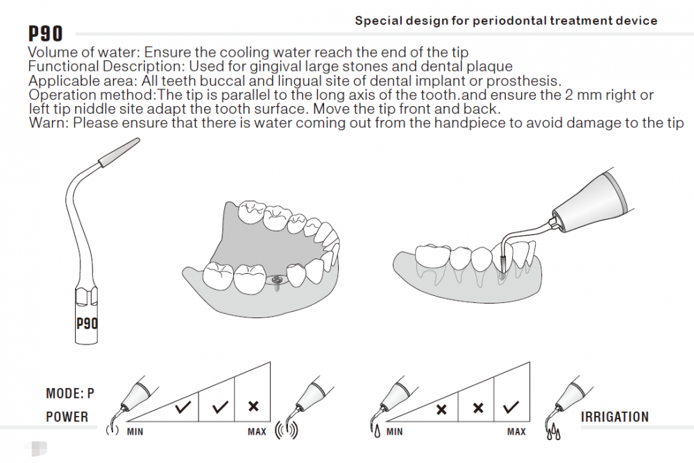 Woodpecker Periodontics Tip PD1,PD2L,PD3,PD4D,,PD12T,PD20T,PD90.. DTE Serie, ,CE/FDA