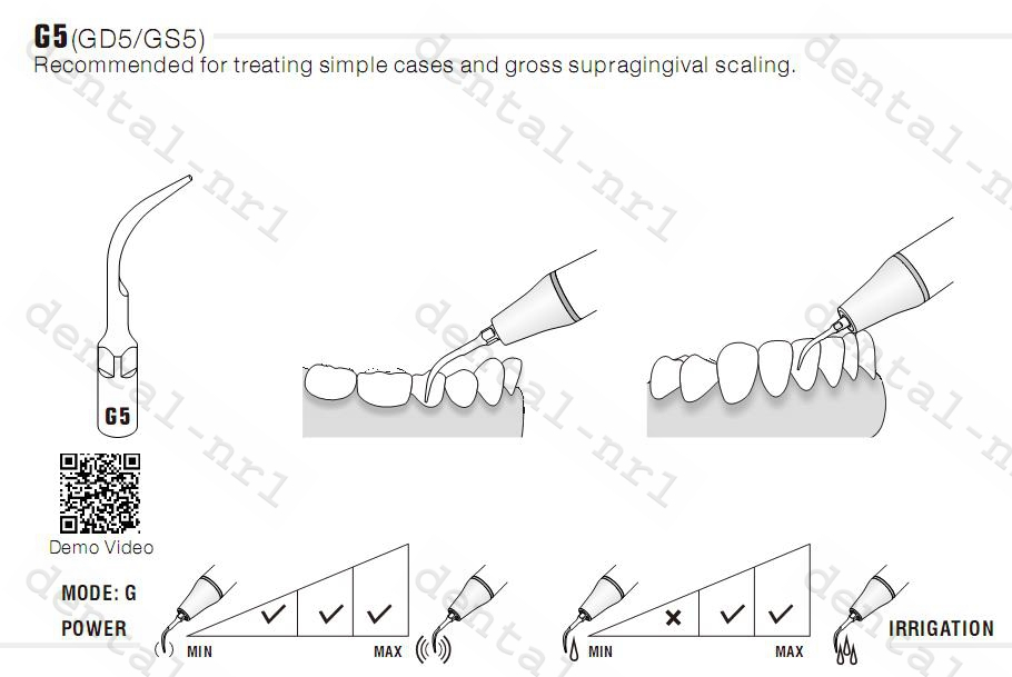 1st WOODPECKER Spitze Tip GS1/GS2/GS3/GS4/GS5/GS6 Serie ,*Sirona compatible CE/FDA