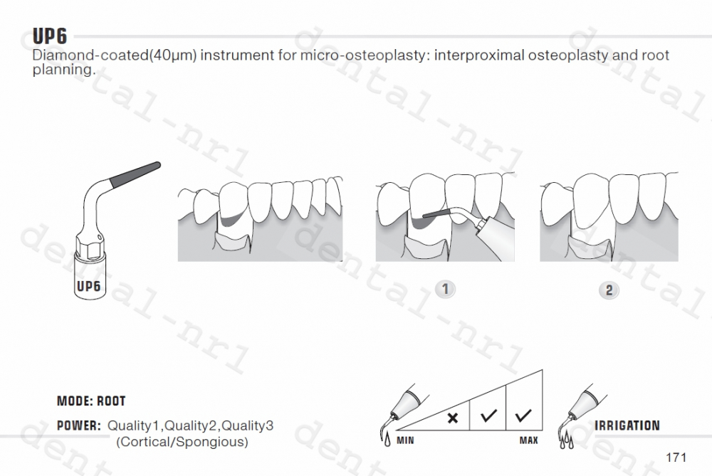 Spitze für Parodontalchirurgie UP1, 2, 3, 4, 5, 6, 7 serie für woodpecker/mectron ultrasurgery,CE/FDA