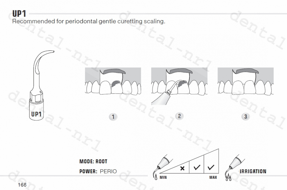 Spitze für Parodontalchirurgie UP1, 2, 3, 4, 5, 6, 7 serie für woodpecker/mectron ultrasurgery,CE/FDA