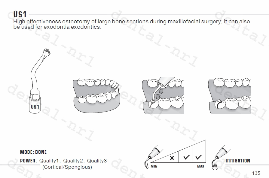 Spitze für Knochenchirurgie US1/ US1L/US1R/ US2/ US3/ US4/ US5/ US6, für woodpecker/* Mectron-Ultrachirurgie, CE/FDA