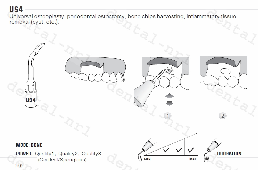 Spitze für Knochenchirurgie US1/ US1L/US1R/ US2/ US3/ US4/ US5/ US6, für woodpecker/* Mectron-Ultrachirurgie, CE/FDA