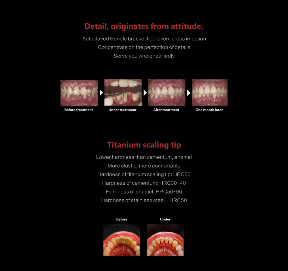 woodpecker original PT5, Piezoelektrisches Keramik-Ultraschallgerät zur schmerzfreien Parodontalbehandlung, Lager in Deutschland,CE/FDA