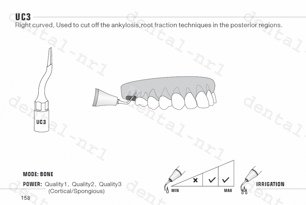Exclcymosis Spitze UC1/ UC2/ UC3 fit woodpecker /mectron ultrasurgery,CE/FDA