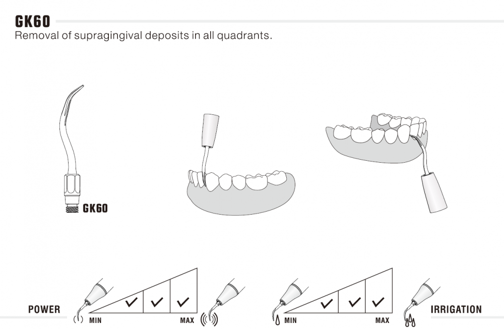 1stk woodpecker ZEG Spitze GK60/ GK61/ GK62, KaVo* Sonicflex 2008 kompatibel ,CE/FDA