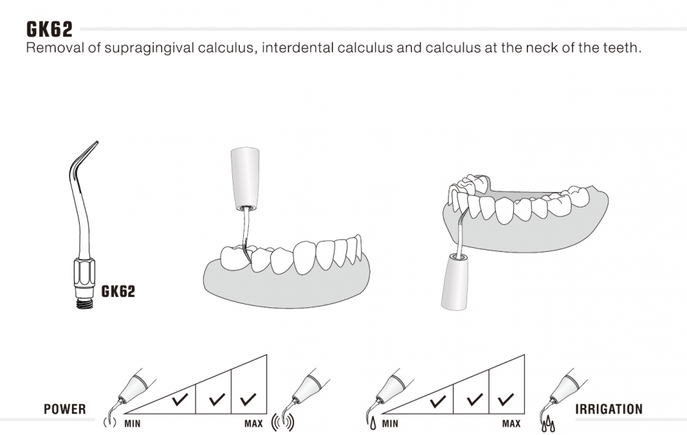 1stk woodpecker ZEG Spitze GK60/ GK61/ GK62, KaVo* Sonicflex 2008 kompatibel ,CE/FDA