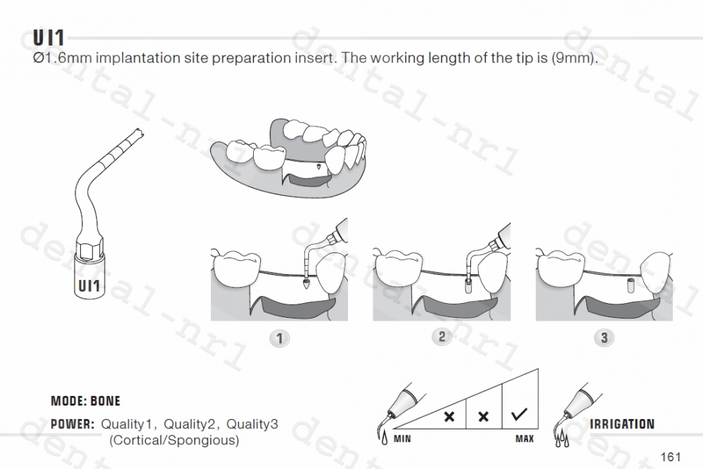 Implantation Spitze UI1, 5, 6, 7 für *mectron /woodpecker ultrasurgery,CE/FDA