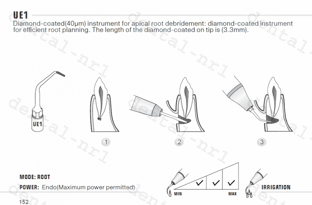 Endodontie Spitze UE1/ UE2/ UE3/ UE4 für woodpecker/ mectron ultrasurgery,CE/FDA