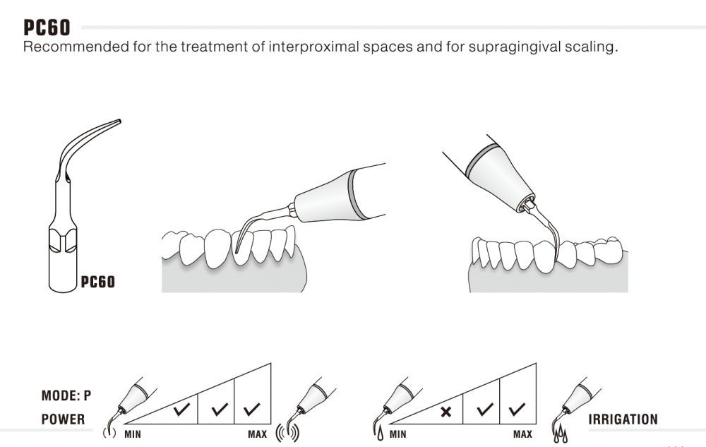 1stk woodpecker ZEG Spitze PC60/ PC61/ PC62, KaVo* Piezo LED kompatibel ,CE/FDA