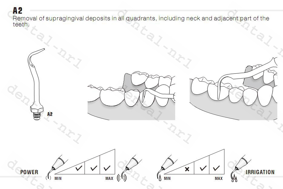 woodpecker Scaler Spitze Tipp A1T, original scaling tip fit AMDENT CE/FDA