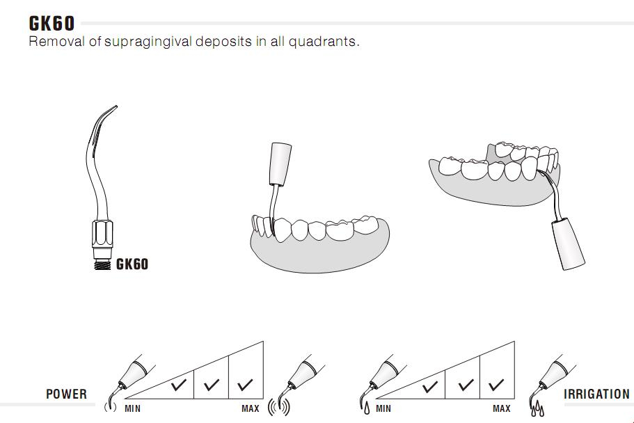 5stk woodpecker ZEG Spitze GK60/ GK61/ GK62, KaVo* Sonicflex 2008 kompatibel ,CE/FDA