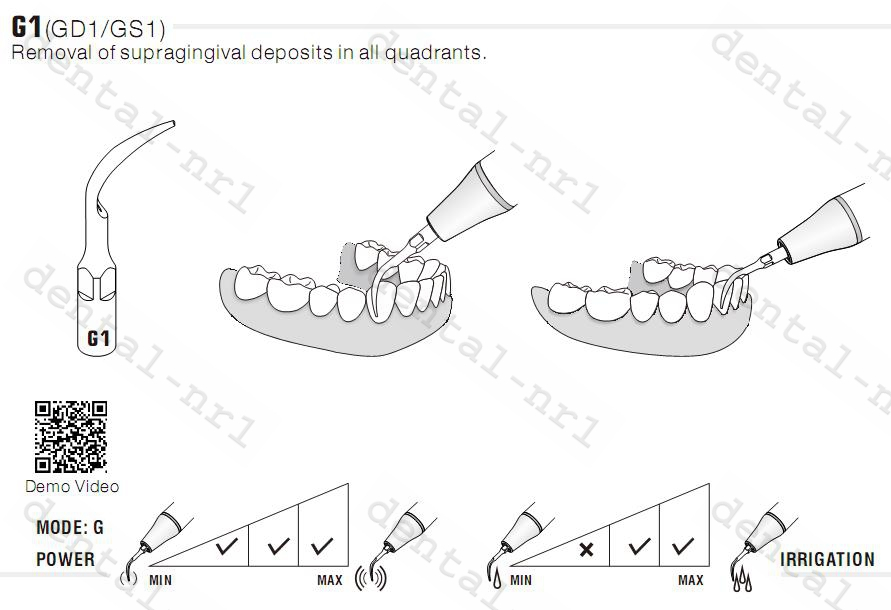 20Stk WOODPECKER Spitze Tip GS1 / GS4,*Sirona compatible CE/FDA
