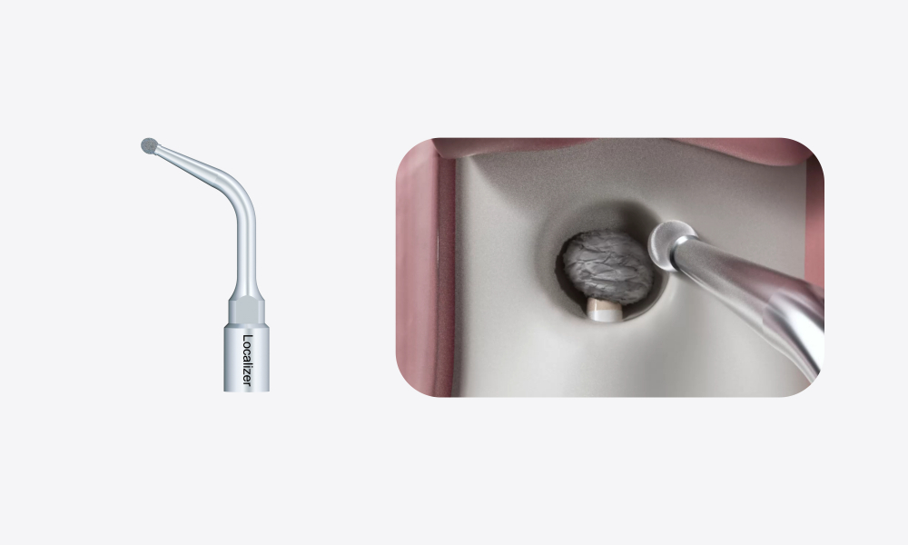 Woodpecker Altaqi Kit – Piezo-Endochirurgie für das Woodpecker-System zur Piezo-Knochenchirurgie (4. Generation),CE/FDA