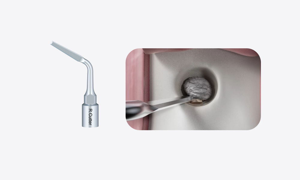 Woodpecker Altaqi Kit – Piezo-Endochirurgie für das Woodpecker-System zur Piezo-Knochenchirurgie (4. Generation),CE/FDA