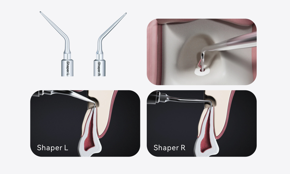 Woodpecker Altaqi Kit – Piezo-Endochirurgie für das Woodpecker-System zur Piezo-Knochenchirurgie (4. Generation),CE/FDA