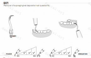 5stk Spitze Tipp GK1/ GK2/ GK3/ GK4/ GK5/ GK6/ GK7, KAVO* air scaler,Soniflex* 2003 kompatibel,CE/FDA