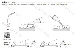 1st WOODPECKER Spitze Tip GS1/GS2/GS3/GS4/GS5/GS6 Serie ,*Sirona compatible CE/FDA