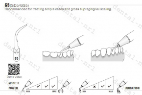 1st WOODPECKER Spitze Tip GS1/GS2/GS3/GS4/GS5/GS6 Serie ,*Sirona compatible CE/FDA