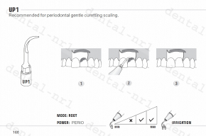 Spitze für Parodontalchirurgie UP1, 2, 3, 4, 5, 6, 7 serie für woodpecker/mectron ultrasurgery,CE/FDA