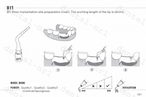Implantation Spitze UI1, 5, 6, 7 für *mectron /woodpecker ultrasurgery,CE/FDA