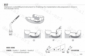 Implantation Spitze UI1, 5, 6, 7 für *mectron /woodpecker ultrasurgery,CE/FDA