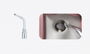 Woodpecker Altaqi Kit – Piezo-Endochirurgie für das Woodpecker-System zur Piezo-Knochenchirurgie (4. Generation),CE/FDA