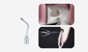 Woodpecker Altaqi Kit – Piezo-Endochirurgie für das Woodpecker-System zur Piezo-Knochenchirurgie (4. Generation),CE/FDA