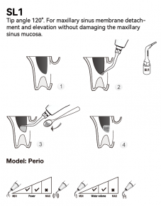 Woodpecker Sinuslifting Spitze SL1, 2, 3, 4, 5, für Surgic Smart von woodpecker/*Acteon kompatibel,CE/FDA