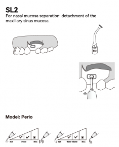 Woodpecker Sinuslifting Spitze SL1, 2, 3, 4, 5, für Surgic Smart von woodpecker/*Acteon kompatibel,CE/FDA