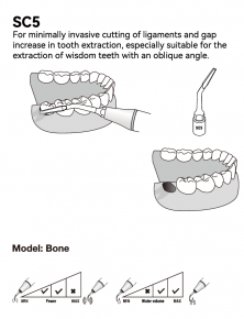 Woodpecker Extraktion Spitze SC1,2,3, für Surgic Smart von woodpecker/*Acteon kompatibel,CE/FDA